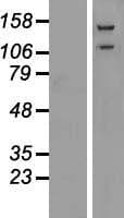 GANAB / Alpha Glucosidase II Protein (Over-Expression Lysate Myc-DDK (Flag))
