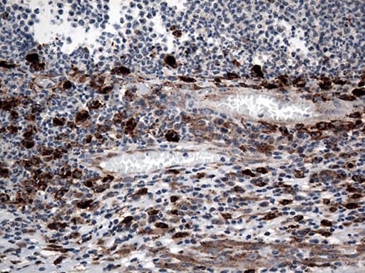 CTSL / Cathepsin L Antibody (aa114-333, clone OTI5A5)
