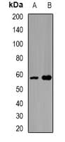 Polyclonal Rabbit anti-Human SPAM1 / PH20 Antibody (IF, WB)