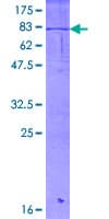 Human DHRS2 / HEP27 Protein (Recombinant GST)