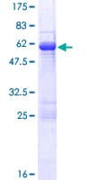 Human RABGGTB Protein (Recombinant GST)