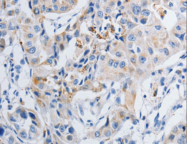 GRIA3 / GLUR3 Antibody