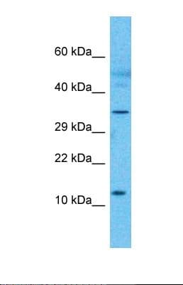 FAM122C Antibody (N-Terminus)
