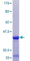 Human TARSH / ABI3BP Protein (Recombinant GST, N-terminus)