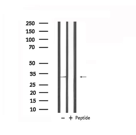 APG5 / ATG5 Antibody