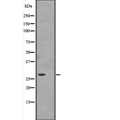 ATP6V1D / V-ATPase subunit D Antibody