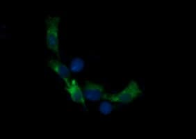 RARRES1 Antibody (clone OTI1A7)