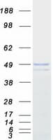 Human PNKD Protein (Recombinant Myc-DDK (Flag))