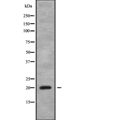 CABP5 Antibody