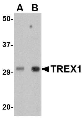TREX1 Antibody