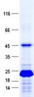 Human KLLN / KILLIN Protein (Recombinant His, N-Terminal)