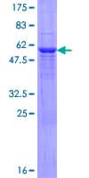 Human NAT2 Protein (Recombinant GST)