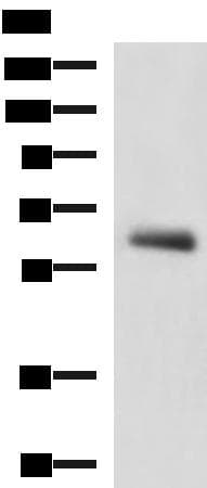 Polyclonal Rabbit anti-Human KBTBD11 Antibody (WB)