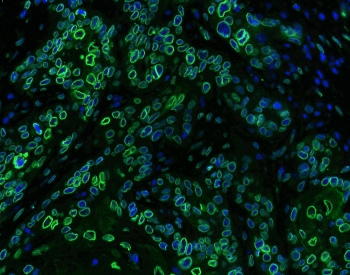 EMD / Emerin Antibody