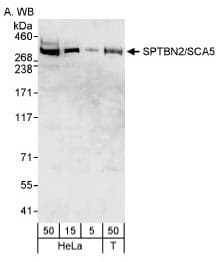 SPTBN2 Antibody (aa2300-2390)