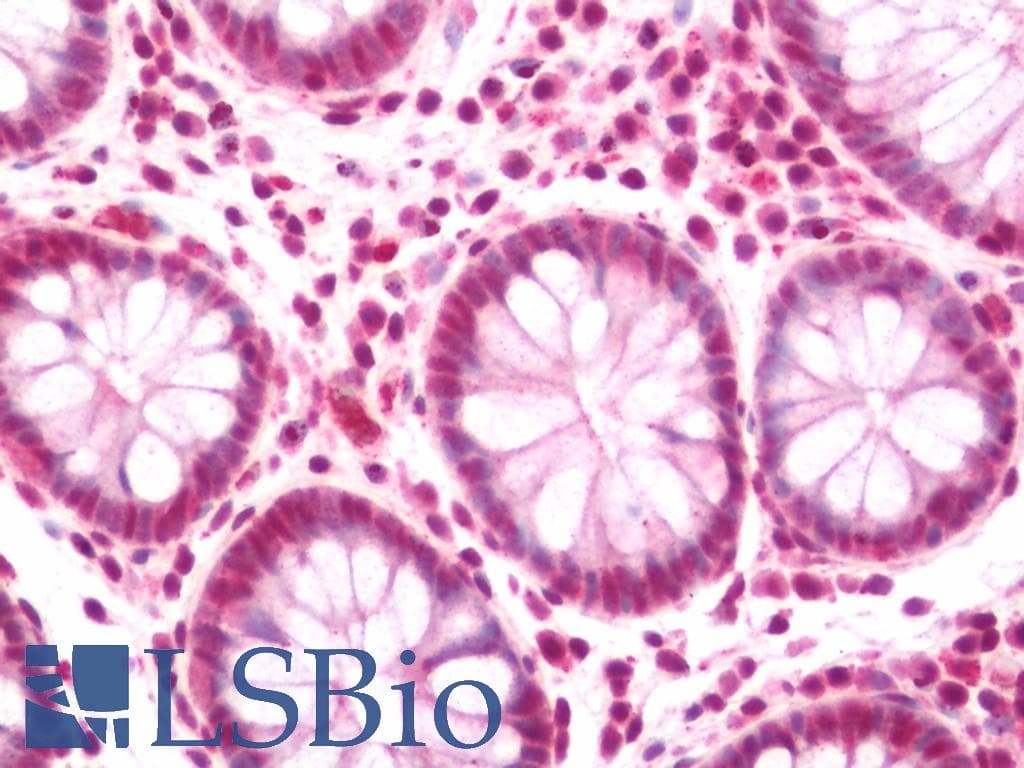 IHC-plus™ KLF17 Antibody