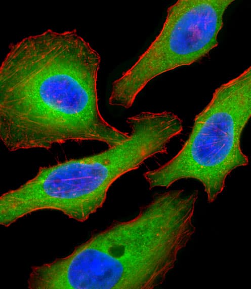 IHC-plus™ Tuberin / TSC2 Antibody (Ser1798)