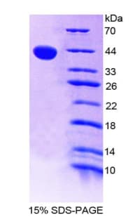 Human CCL11 / Eotaxin Protein (Recombinant His-GST)