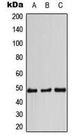 CCNE1 / Cyclin E1 Antibody (C-Terminus)