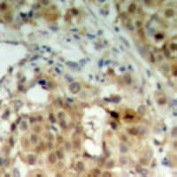 HNRNPK / hnRNP K Antibody (Internal)
