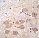 PCDH1 / PCD1 Antibody (aa179-206)