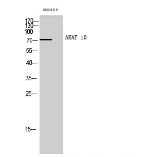 AKAP10 Antibody (10-90 aa, N-terminal)