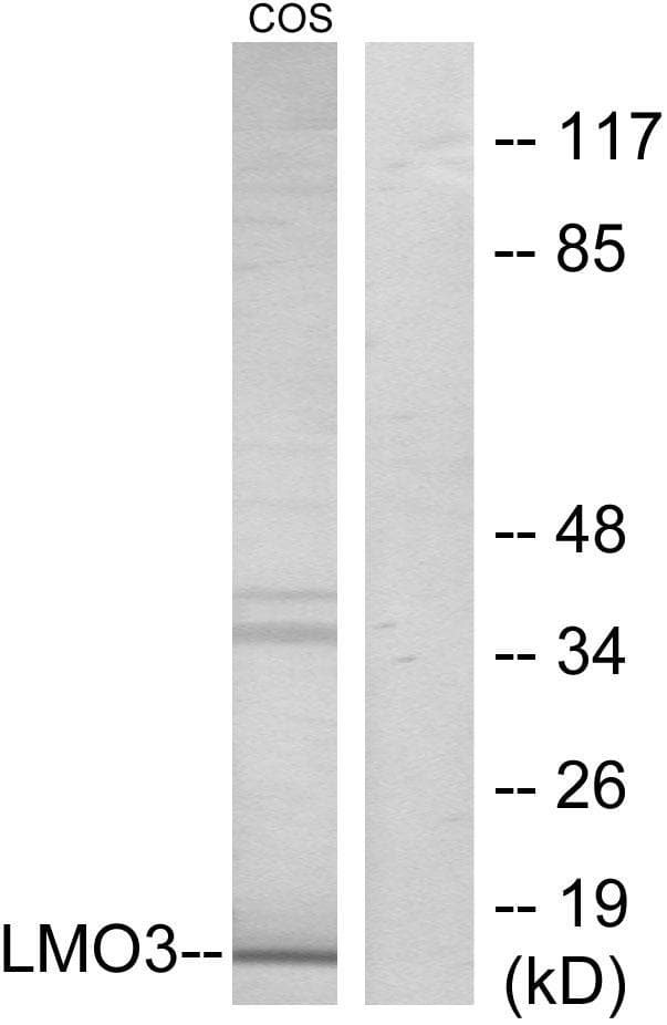 DAT1 / LMO3 Antibody