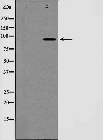 NOTCH1 Antibody (Cleaved Val1744)