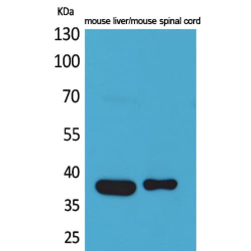 ALDOC / Aldolase C Antibody (21-70 aa, N-terminal)
