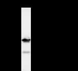 DDX3 / DDX3X Antibody (clone 2253C5a)