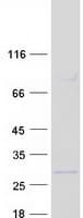 Human NDUFB9 Protein (Recombinant Myc-DDK (Flag))