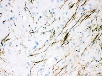 Polyclonal Rabbit anti-Human Tyrosine Hydroxylase Antibody (IHC, WB)