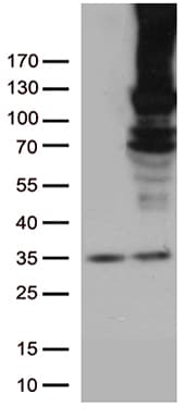 RB1 / Retinoblastoma / RB Antibody (aa309-590, clone OTI1B1, Carrier-free)