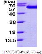 Human FSCN1 / Fascin Protein (Recombinant His)