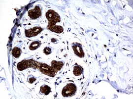 NME1 / NM23 Antibody (clone OTI1A12)