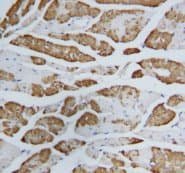 FABP3 / H-FABP Antibody (aa119-133)