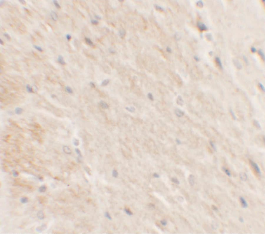 DDX41 / ABS Antibody