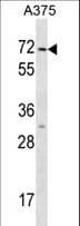 KRT75 / Keratin 75 / K6HF Antibody (aa66-92)