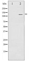 CD144 / CDH5 / VE Cadherin Antibody
