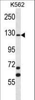 MCF2 / DBL Antibody (aa804-833)