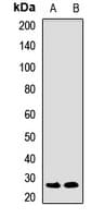 KLRD1 / CD94 Antibody