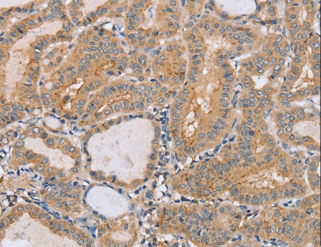 PTPMEG / PTPN4 Antibody