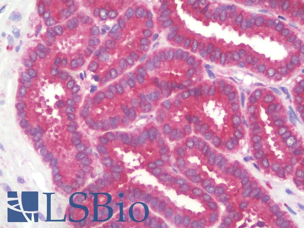 PathPlus™ Polyclonal Rabbit anti-Human RAB5A / RAB5 Antibody (aa182-211, IHC, IF, WB)