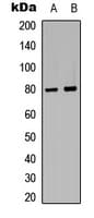 ADRBK1 / GRK2 Antibody (C-Terminus)