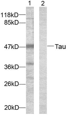 MAPT / Tau Antibody (p396)