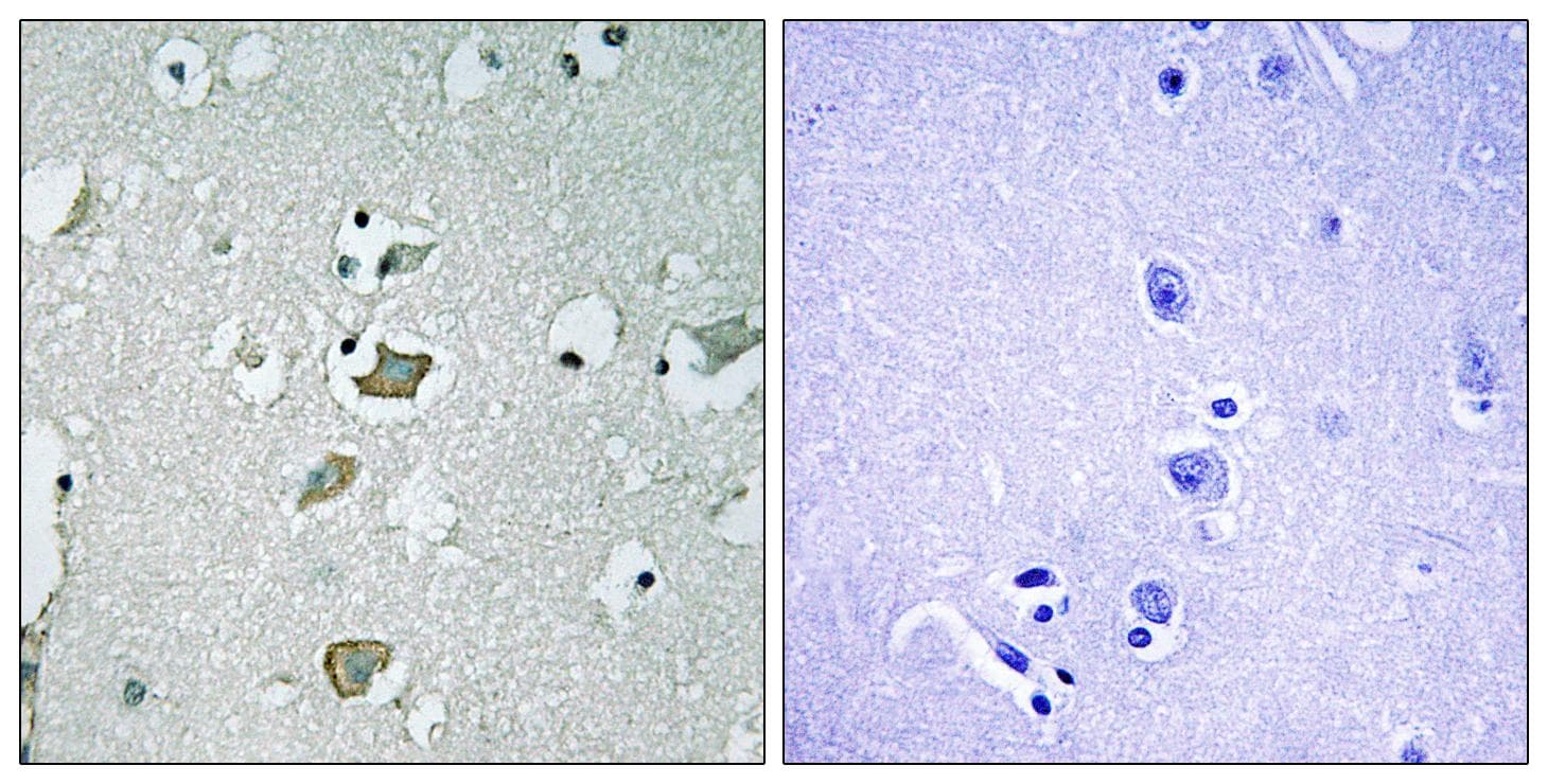 KCNJ2 / Kir2.1 Antibody
