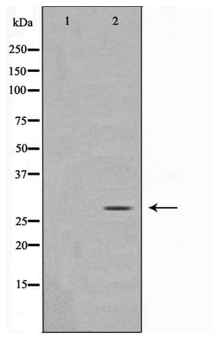 MOB4 / PHOCN Antibody