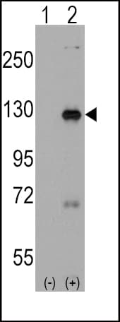 DAAM1 Antibody (aa1034-1063)