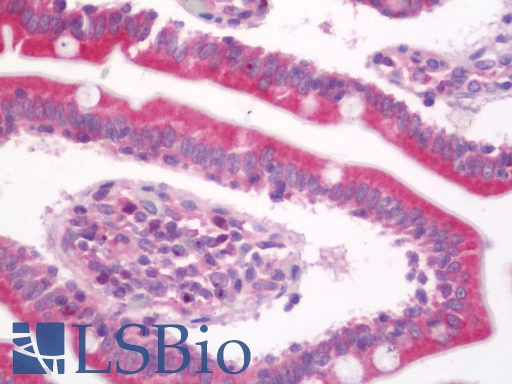 IHC-plus™ Polyclonal Rabbit anti-Human LTK Antibody (aa206-255, IHC, WB)