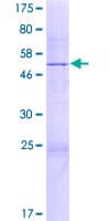 Human SPC25 Protein (Recombinant GST)